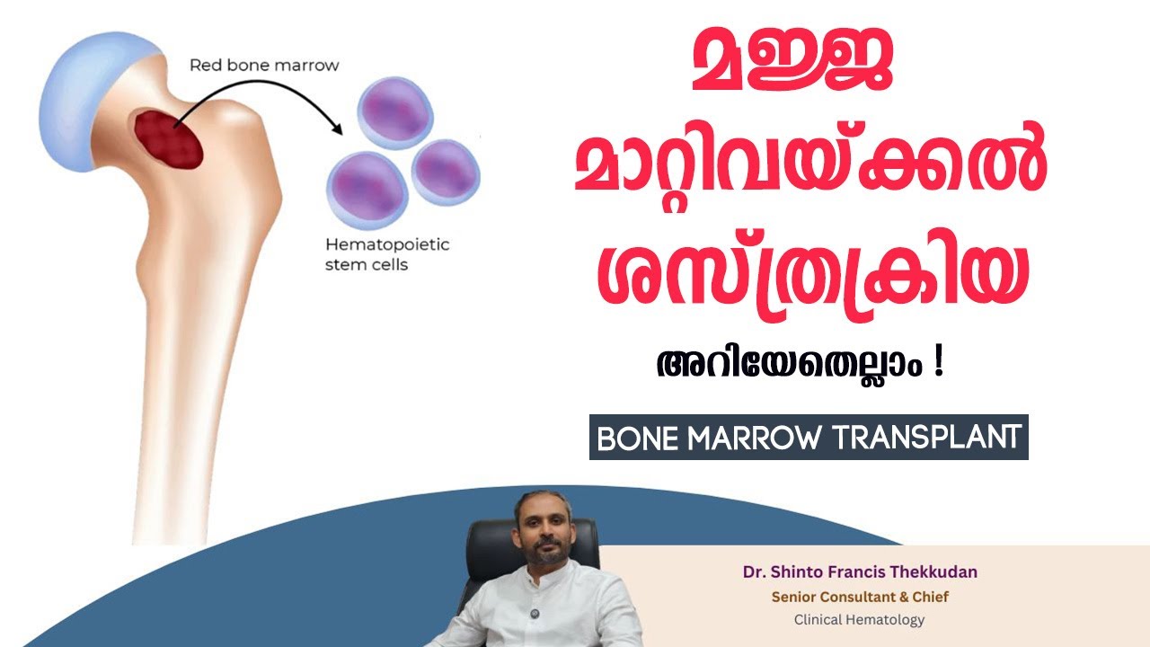 മജ്ജ മാറ്റിവയ്ക്കൽ ശസ്ത്രക്രിയ  || Bone Marrow Transplant || Dr. Shinto Francis Thekkudan