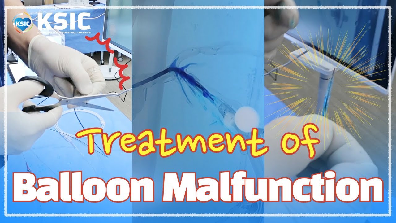 [SUB]Treatment of Balloon Malfunction