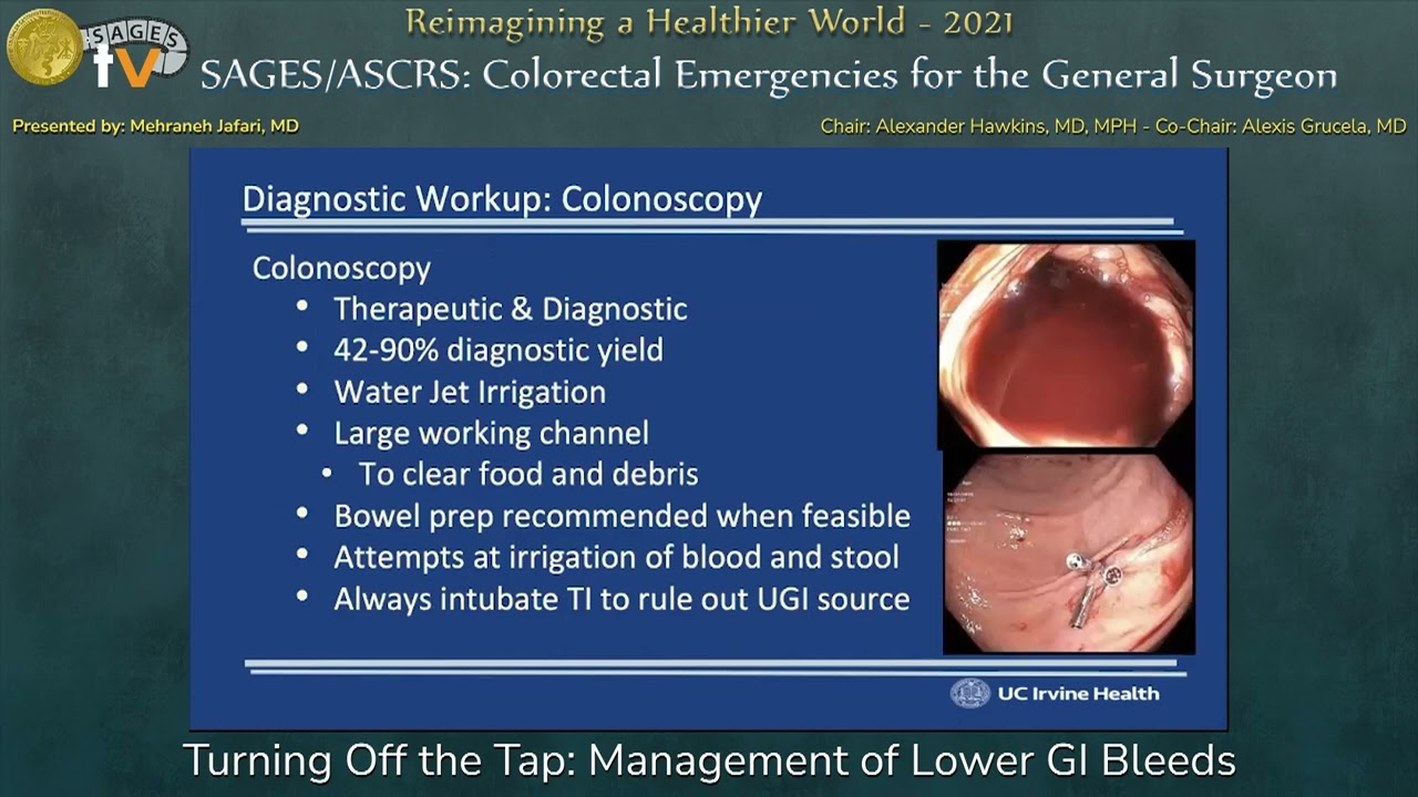 Turning Off the Tap: Management of Lower GI Bleeds