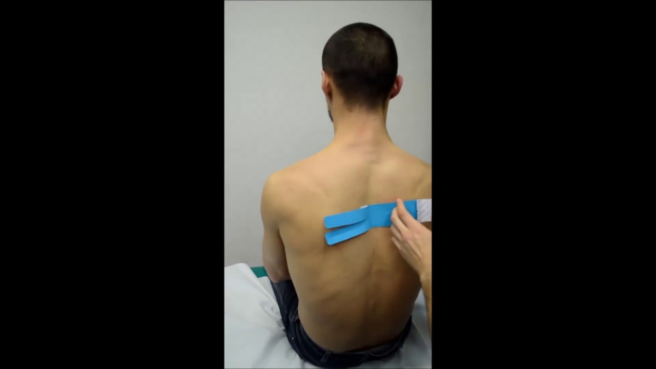 Kinesio taping sui muscoli romboidi del dorso