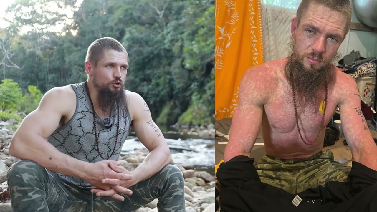I survived 2 deadly jungle diseases in the past year (Leishmaniasis, Dengue)