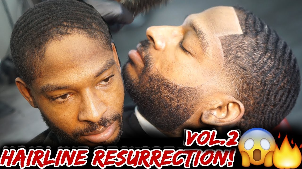 *MUST SEE* Hairline Resurrection Vol.2