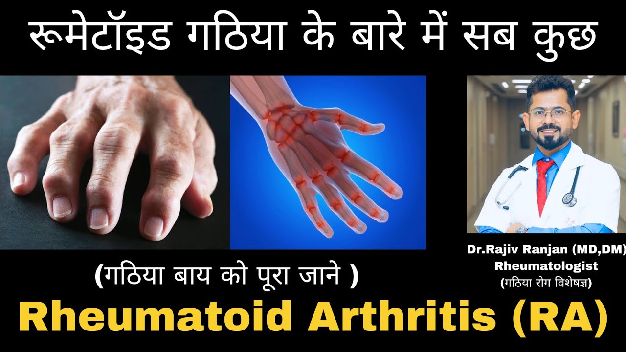 गठिया बाय | रूमेटॉइड गठिया पूरी जानकारी | All About Rheumatoid Arthritis (RA)