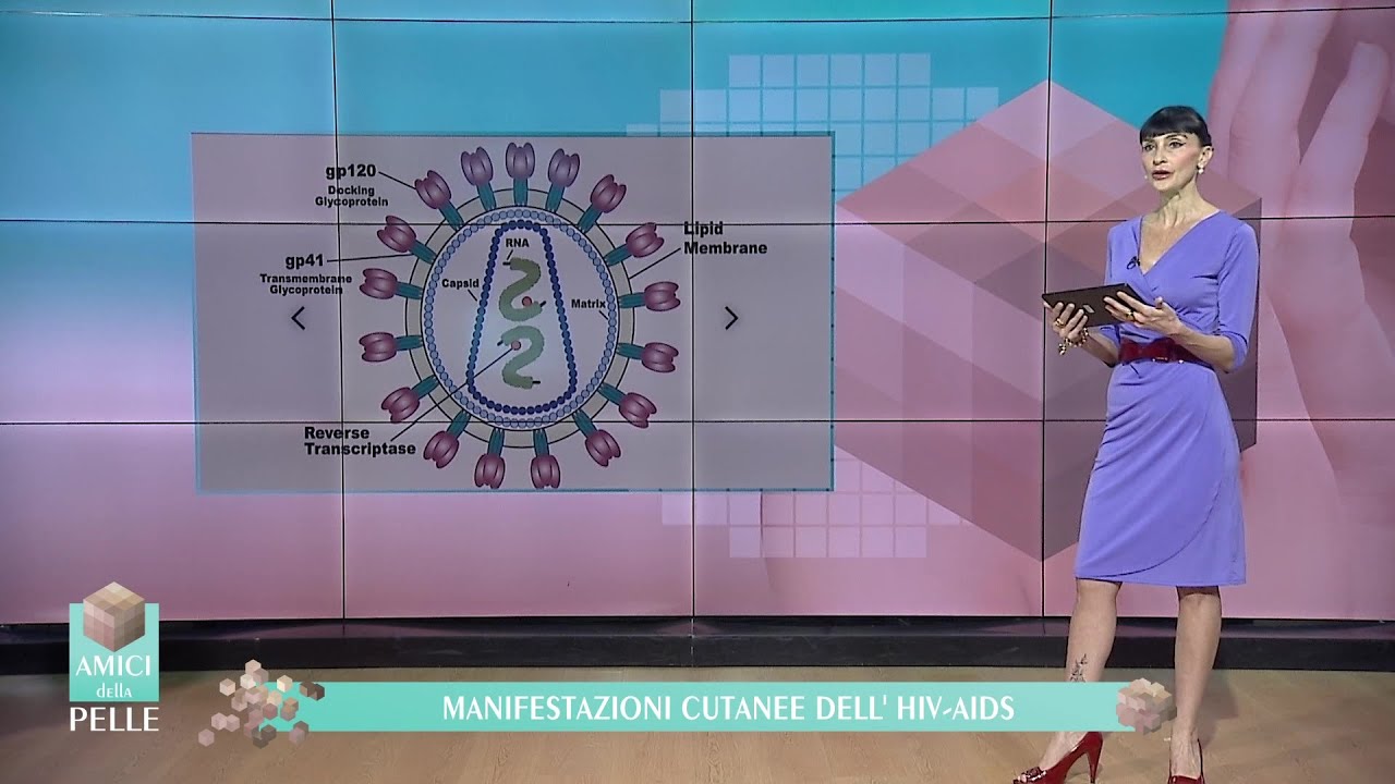 MANIFESTAZIONI CUTANEE DELL'HIV-AIDS
