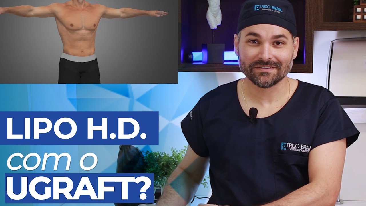 UGRAFT NA LIPO HD O que é e como funciona?