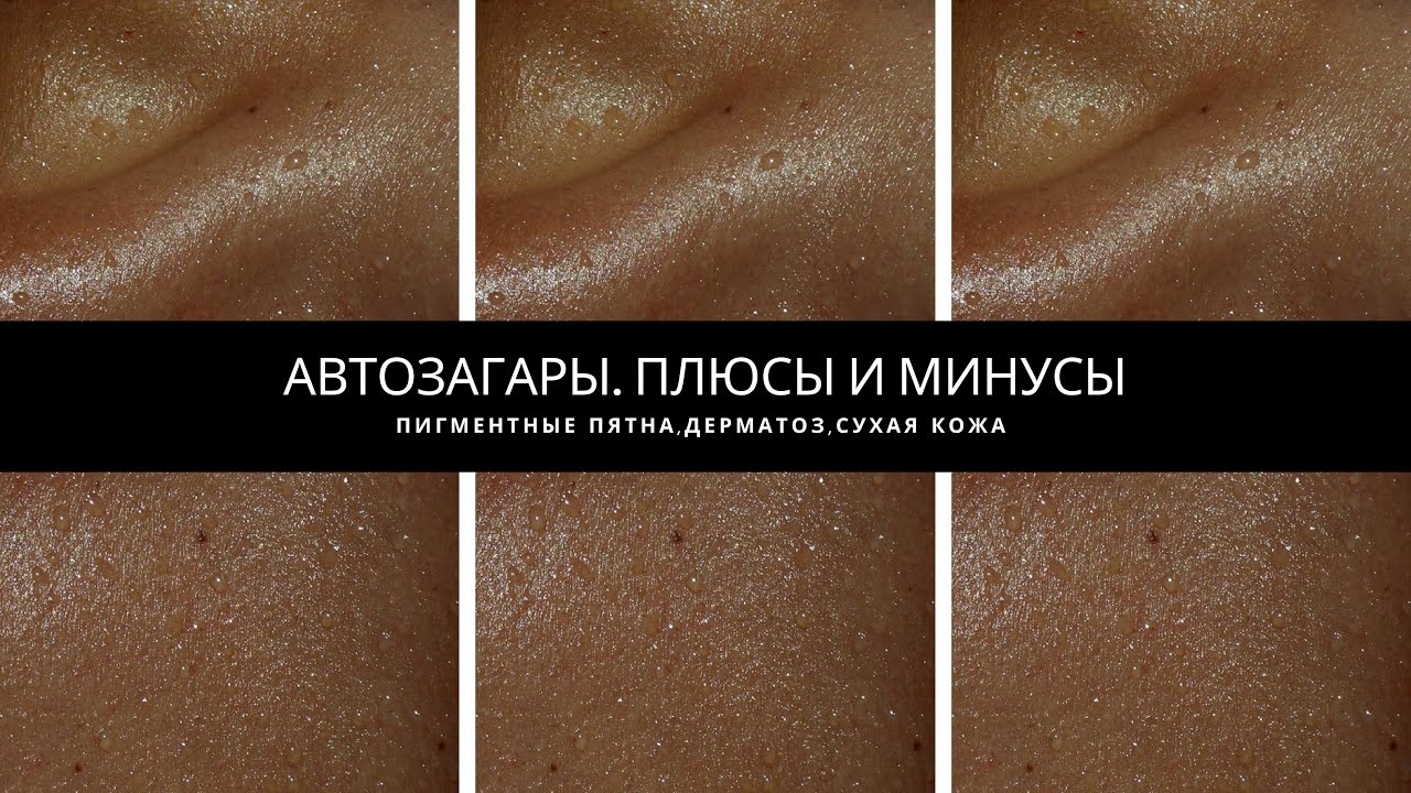 АВТОЗАГАР. ПЛЮСЫ И МИНУСЫ. ТАКОГО ВАМ НЕ РАССКАЖЕТ НИКТО.