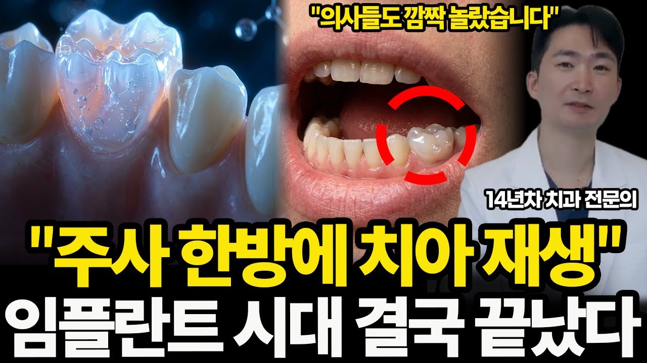 &ldquo;임플란트 시대 끝난다