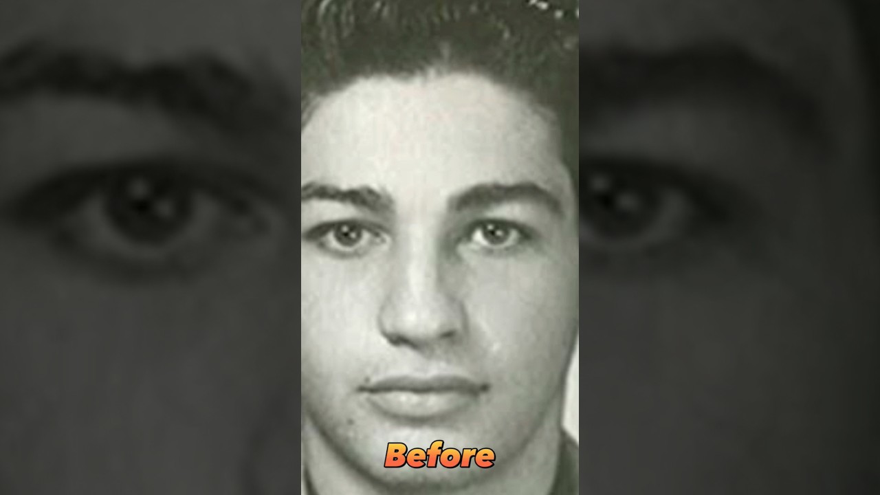 Carlos Slim Helu Before After