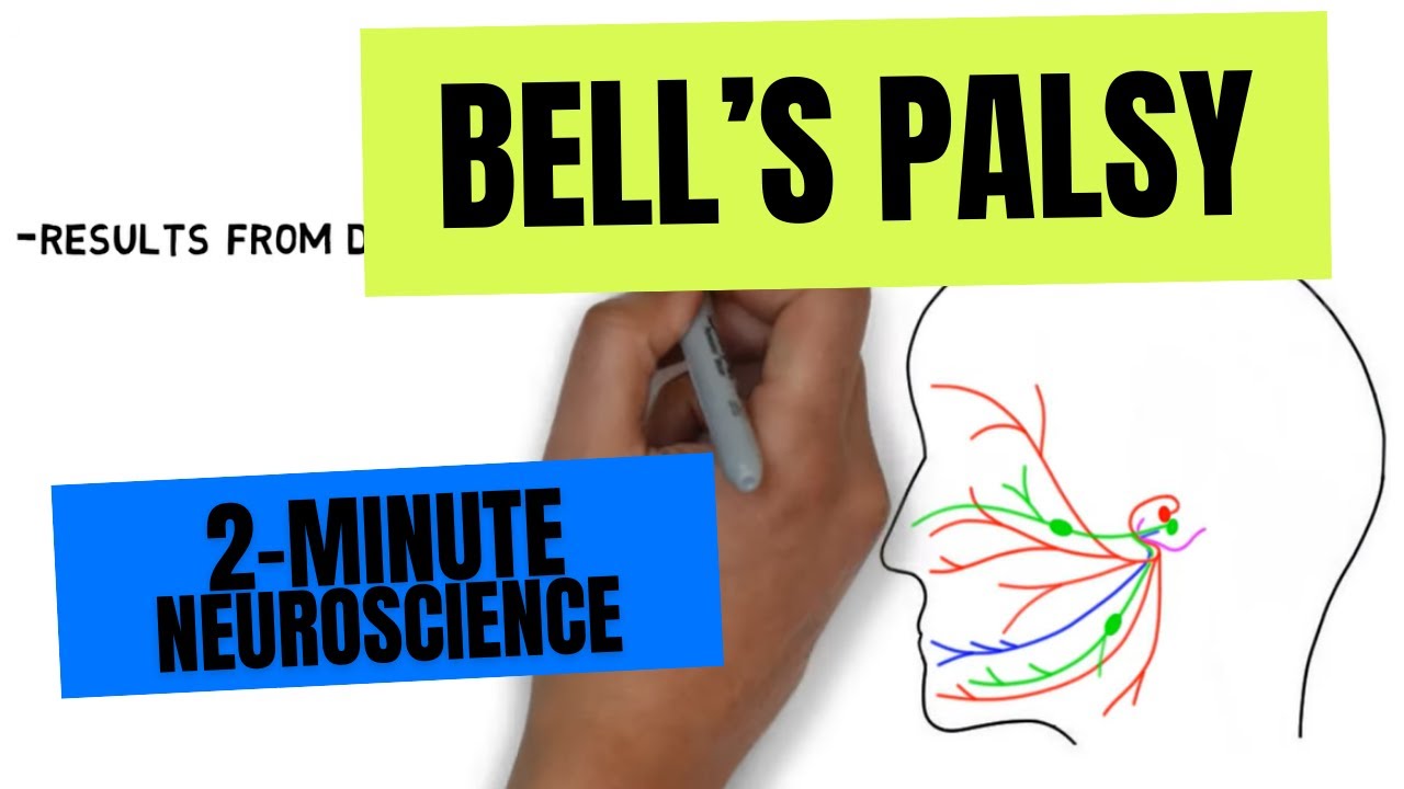 2-Minute Neuroscience: Bell's Palsy