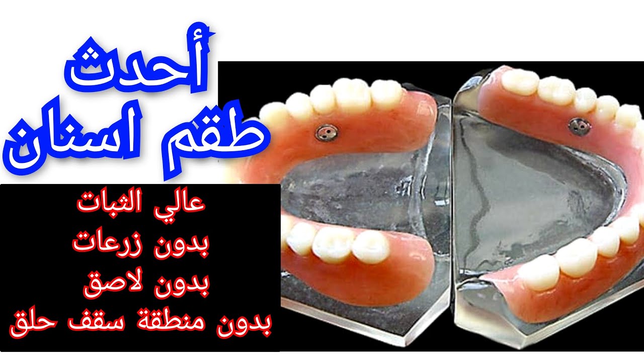 أحدث تقنية طقم أسنان متحرك عالي الثبات جداً بدون زرعات بدون لاصق بدون منطقة سقف حلق علوية المزعجة