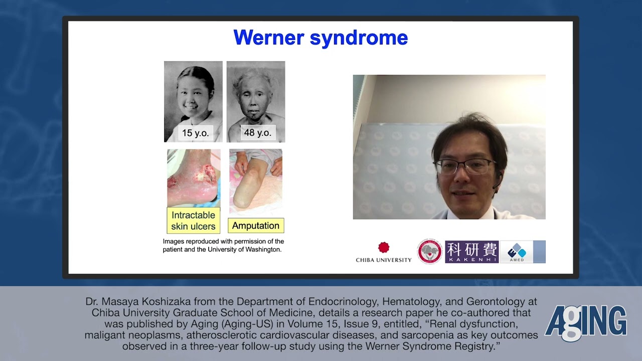 Behind the Study: Outcomes Observed in Follow-Up Study Using Werner Syndrome Registry | Aging-US