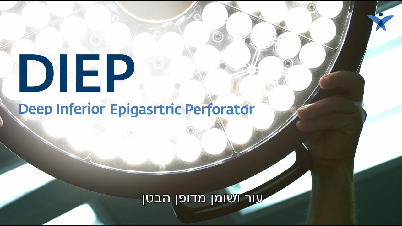 שחזור שד טבעי מרקמת גוף (DIEP) - ד