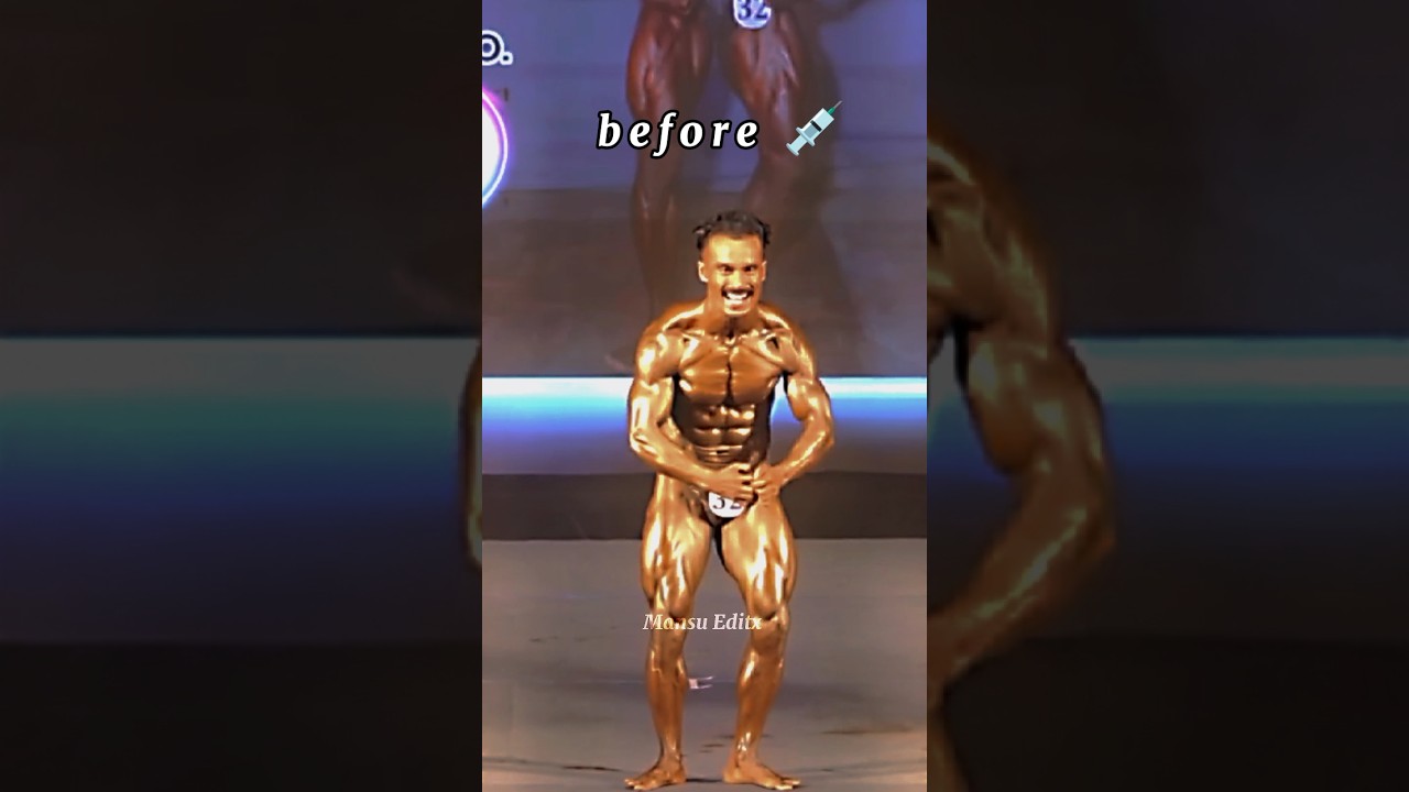Before 💉  V⚡S  After 💉 Chris Bumstead 🥵 #bodybuildingedit #apnabuilder #boybuilding #gym #shorts