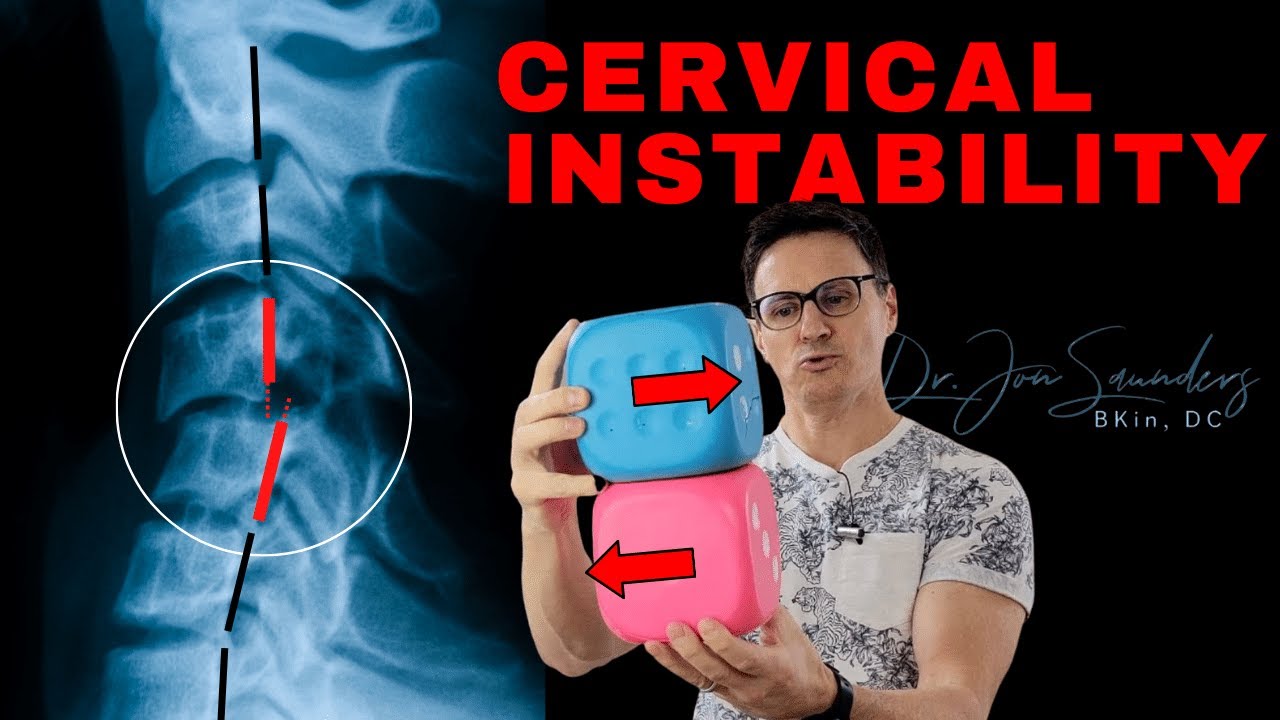 Cervical Instability: What You Should Know | Dr. Jon Saunders