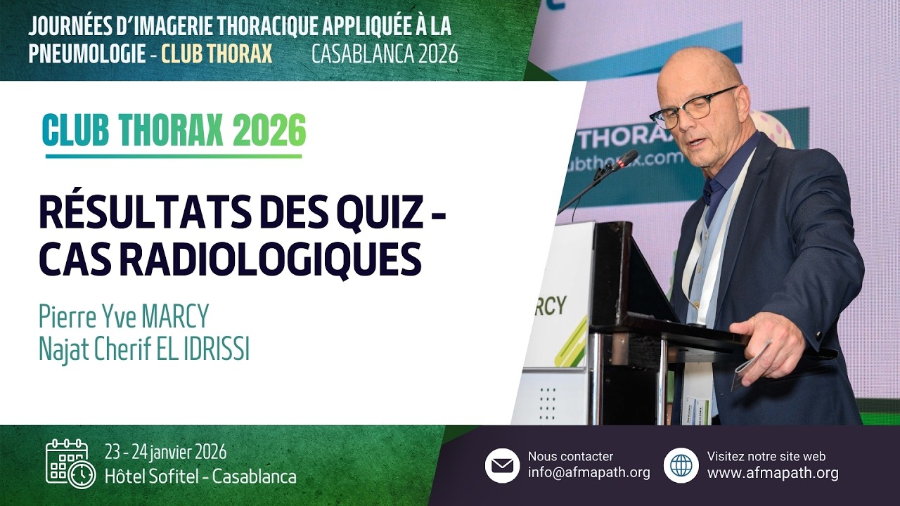 Résultat des quiz & Remise du prix