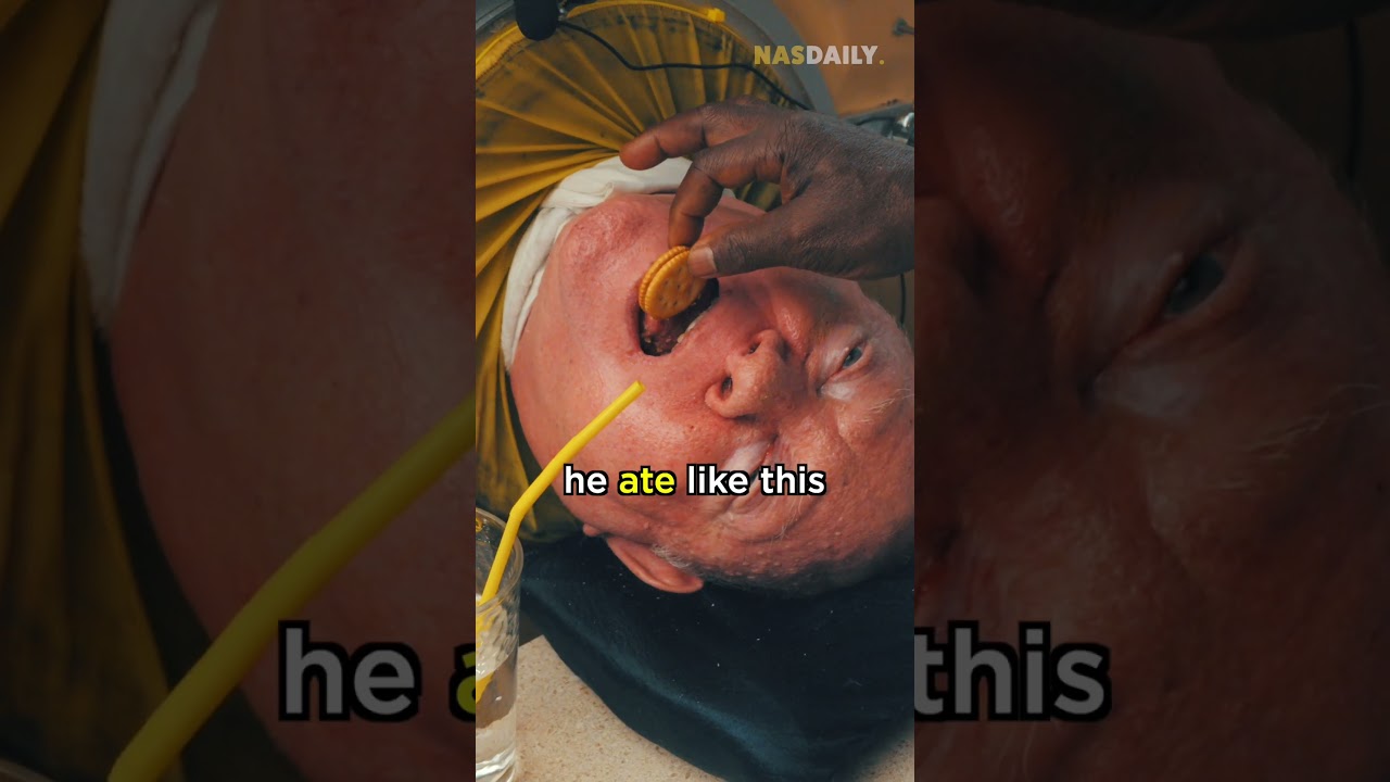 The Man in the Iron Lung