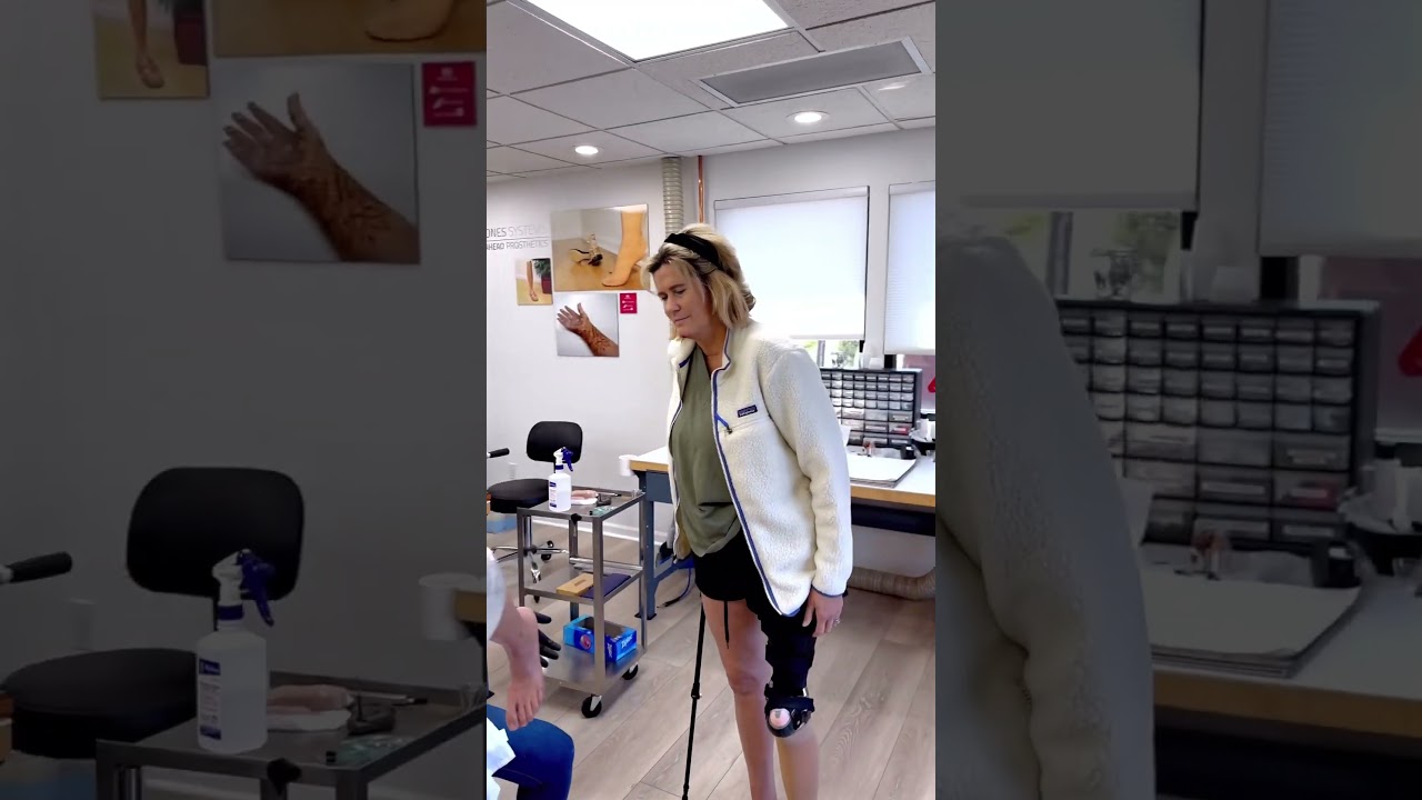 Mara Recieves her 1st Realistic Silicone Rotationplasty Prosthetic