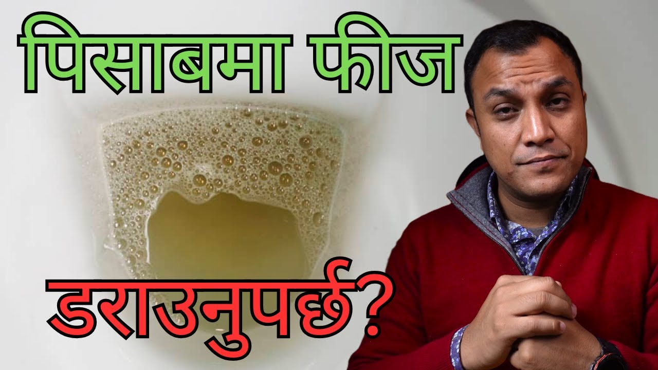 पिसाबमा फीस आएर मृगौला बिग्रिनु अघि कस्तो लक्ष्यण आउँछ? Symptoms of protein leakage in urine
