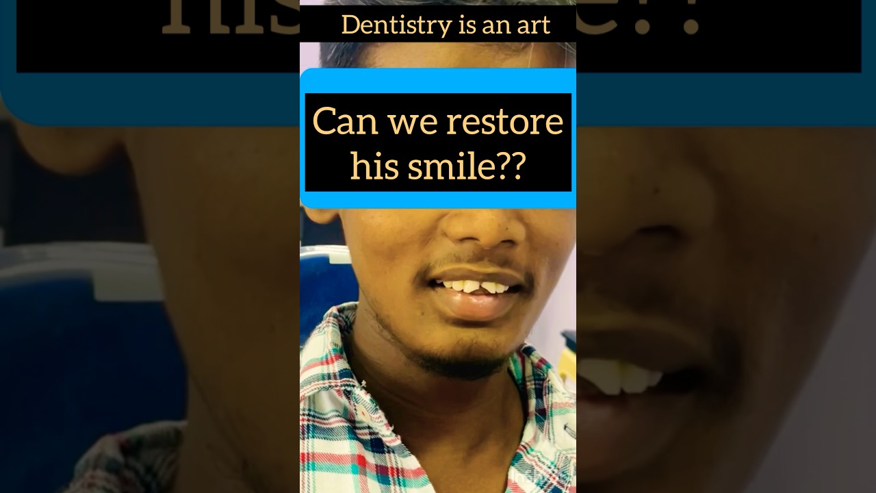 Smile makeover