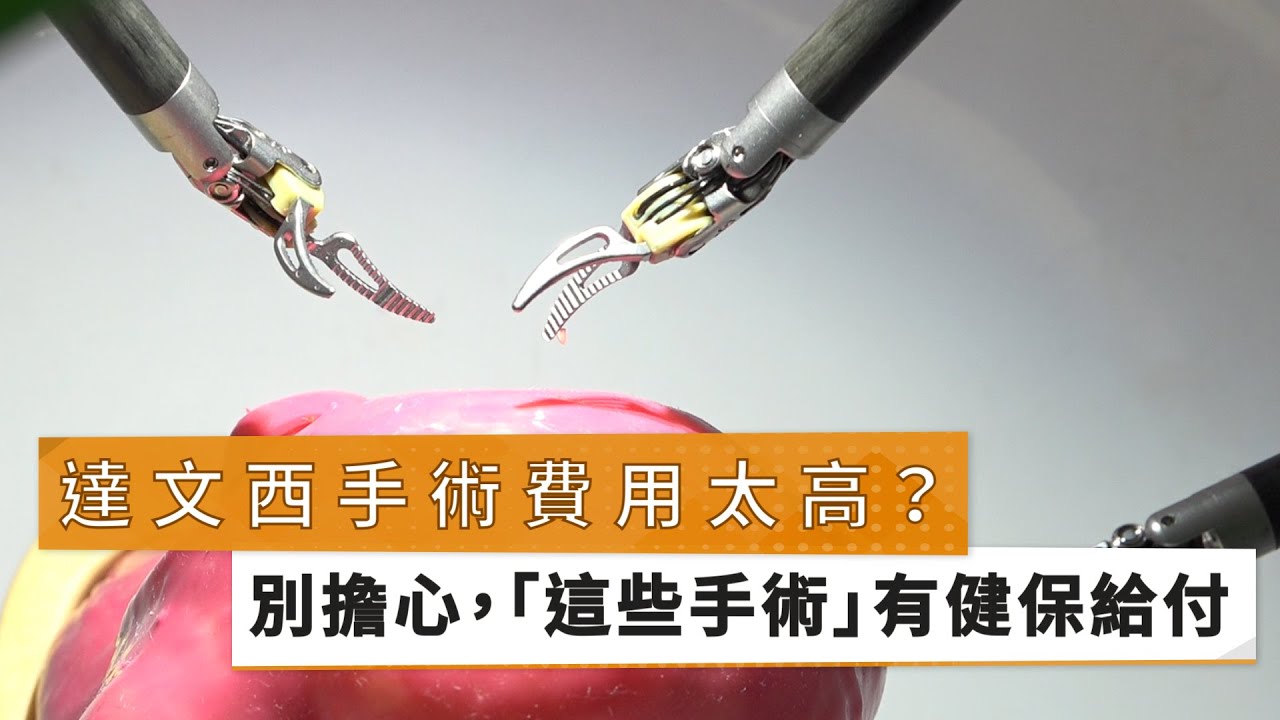 【陳偉傑醫師、陳正哲醫師、溫聖辰醫師】達文西手術費用太高　 別擔心，「這些手術」有健保給付｜健康醫療網