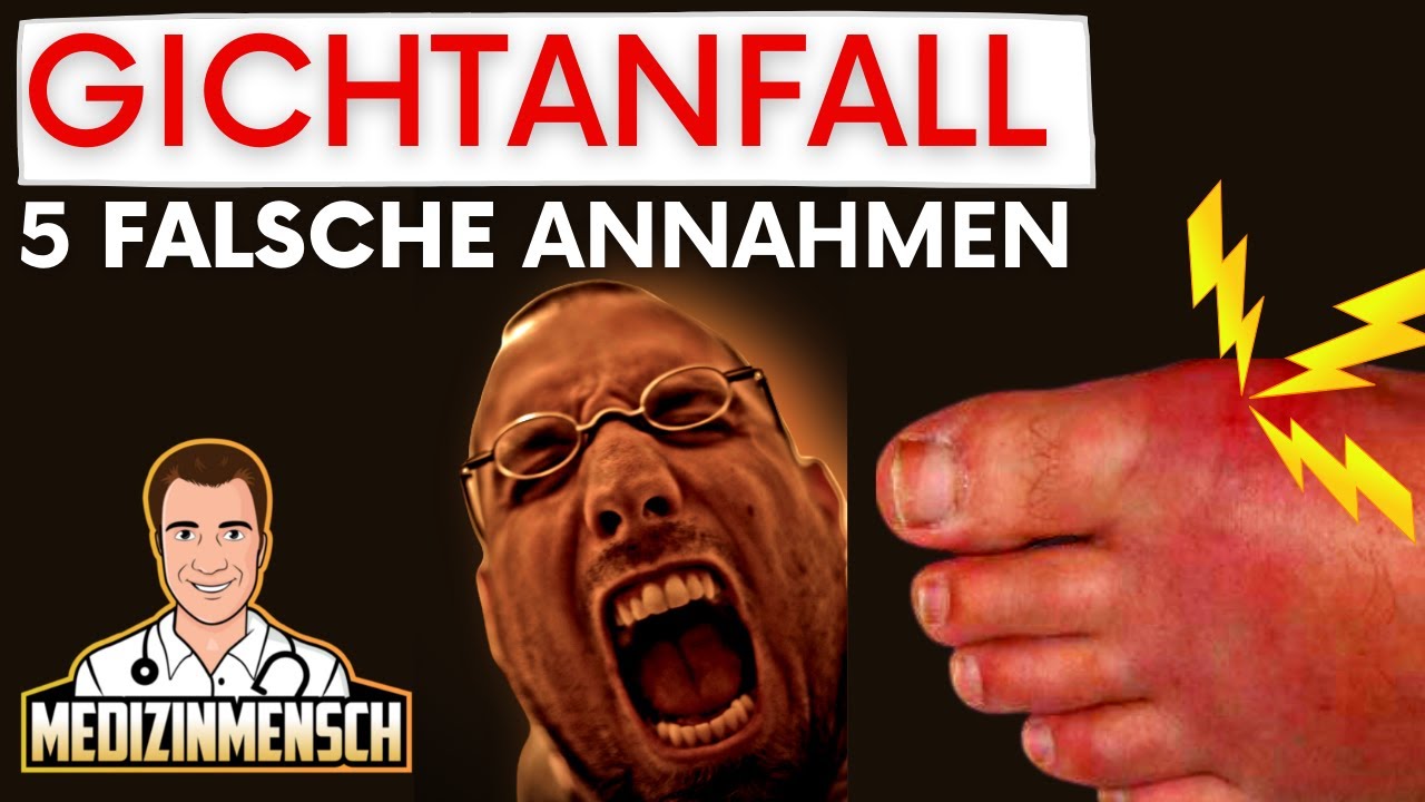 Gicht: 5 Irrtümer die Du UNBEDINGT vermeiden solltest! (Arzt erklärt Fehlannahmen bei Gicht)