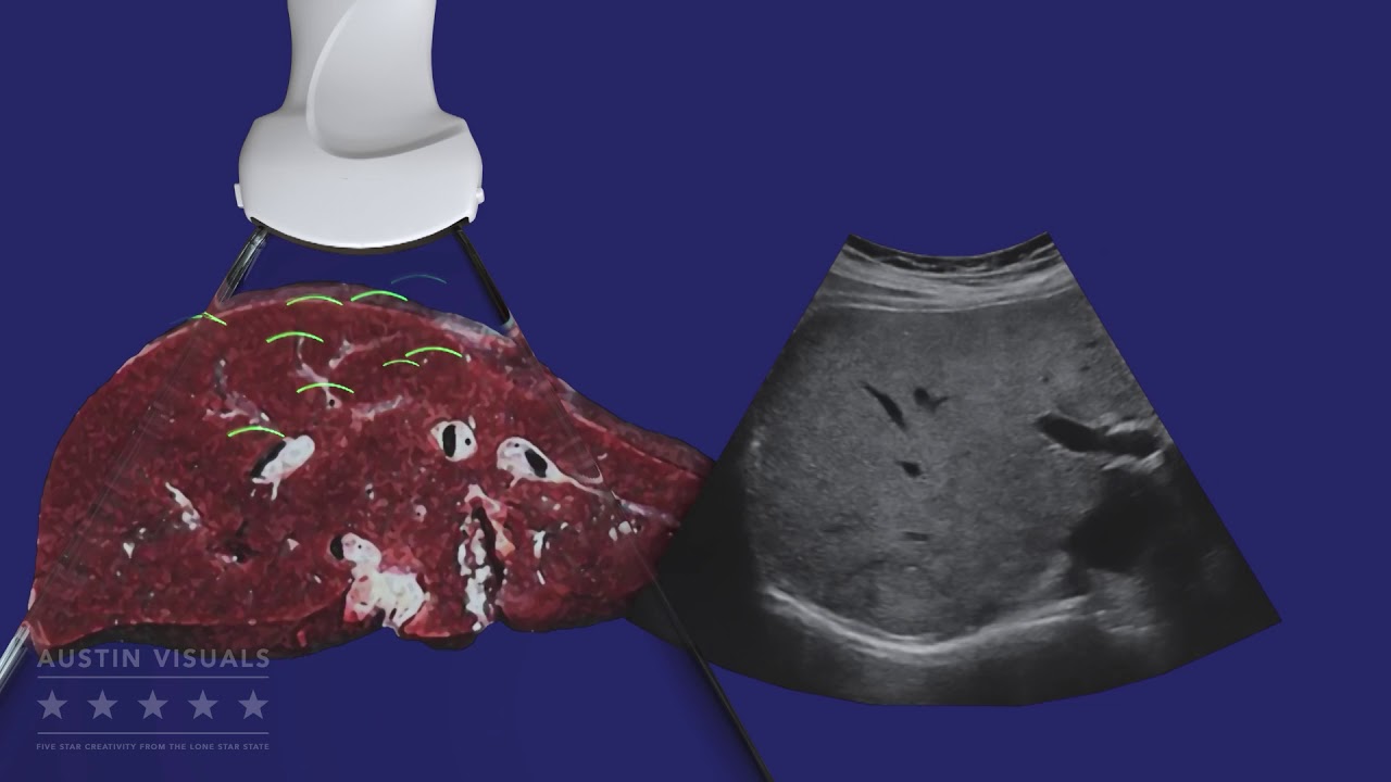 Ultrasound 3D Device Explainer Animation