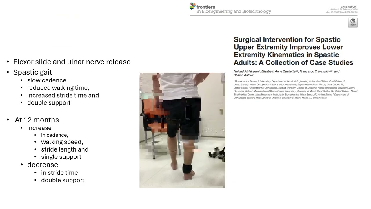 Management of Clenched Fist in Stroke Patients: Surgical and Therapeutic Approaches