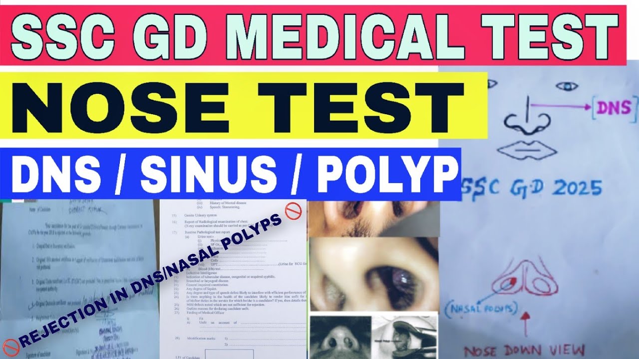 🇮🇳SSC GD 2025 ||✅MEDICAL TEST || NOSE TEST ||😱DNS/SINUS /NASAL POLYPS ||🚫MEDICAL POINTSℹ️||◀️A to Z 