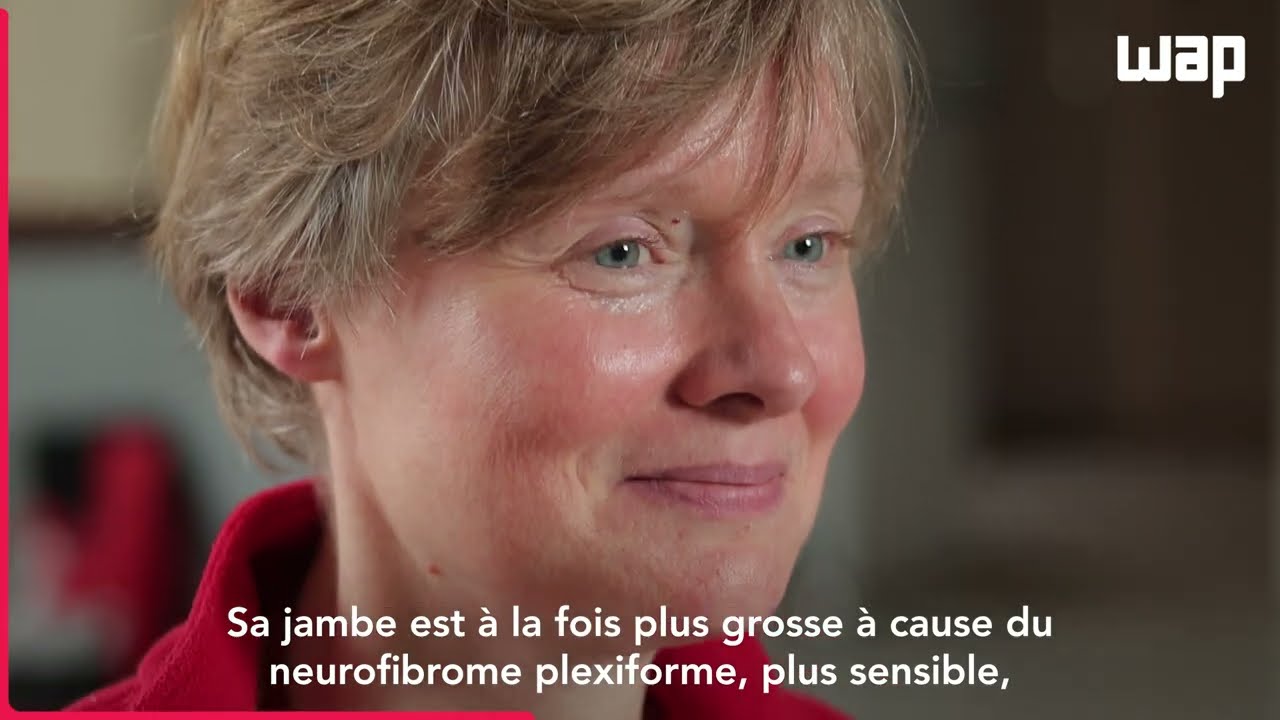 Témoignage de Cécile Gain NF1 - Alexion