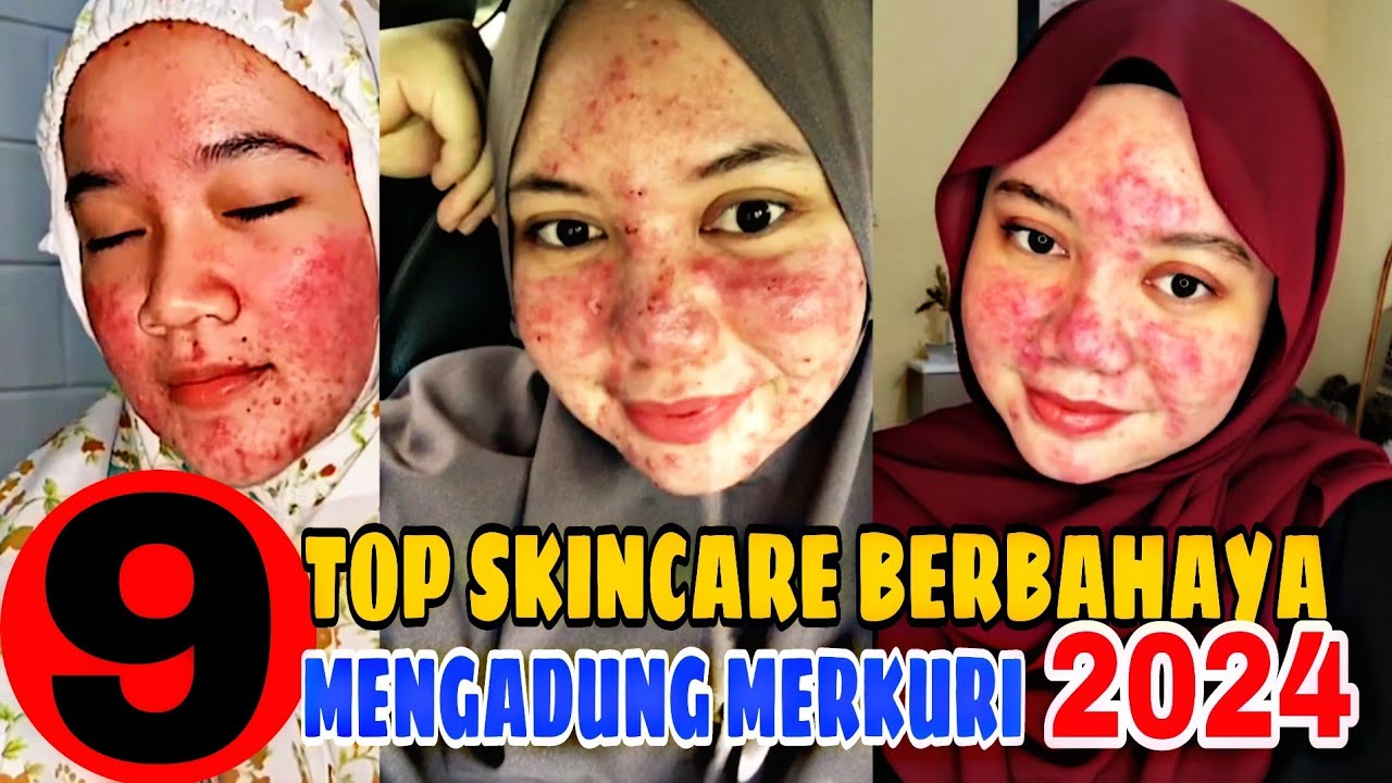 9 TOP SKINCARE MENGADUNG MERKURI  2024 ✅ BAHAYA MERUSAK KULIT WAJAH