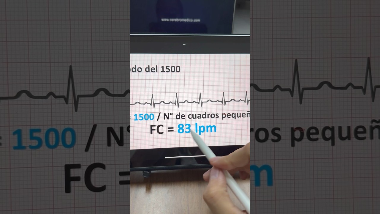 M&eacute;todo del 1500 para calcular la FC en el ECG #medicina