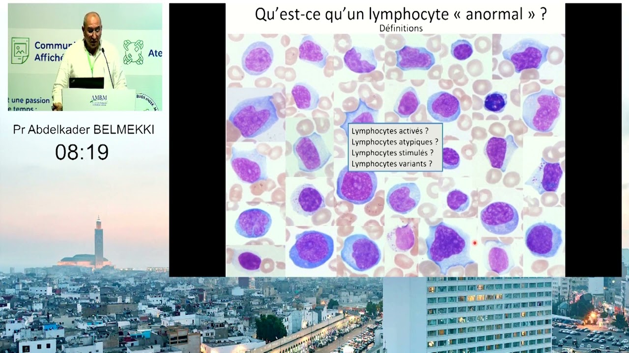 Aspect cytohematologique et DC différentiel Pr Abdelkader BELMEKKI
