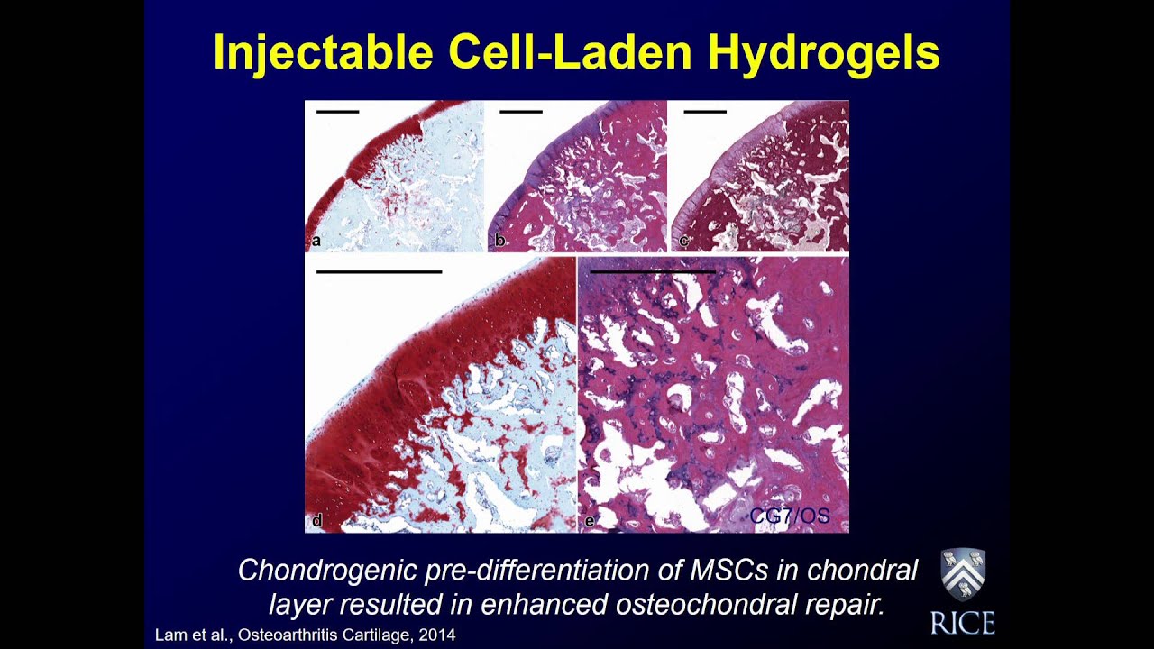 Antonios G. Mikos, Ph.D., on Biomaterials for Tissue Engineering