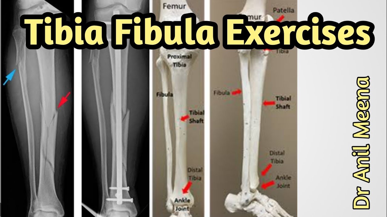 tibia fibula fracture exercises | tibia fracture recovery exercises | tibia fracture physiotherapy