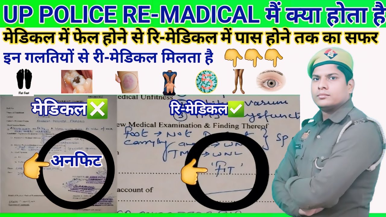 UP POLICE RE-MADICAL ME KYA HOTA H | रि-मेडिकल किन कारण से मिलता है RE-MADICAL ME PASS HONE KA TRIKA