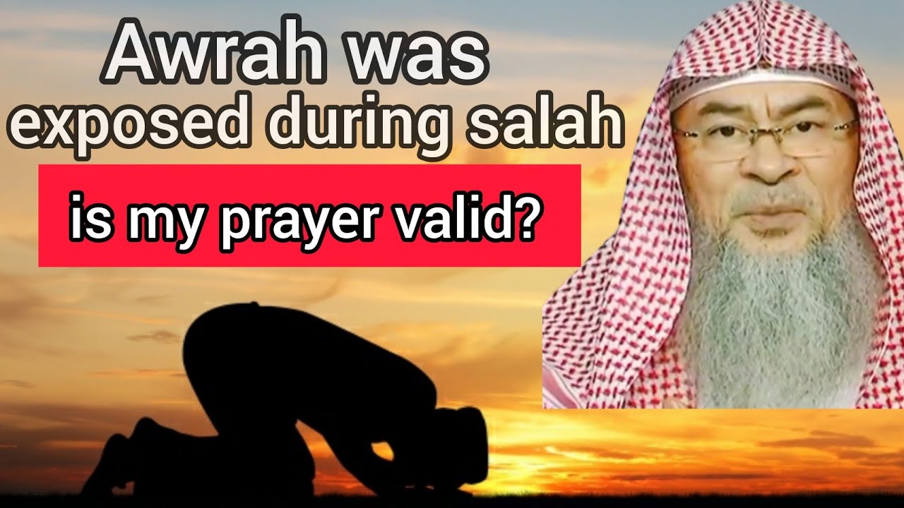 Awrah was exposed during salah, is the prayer valid? - Assim al hakeem