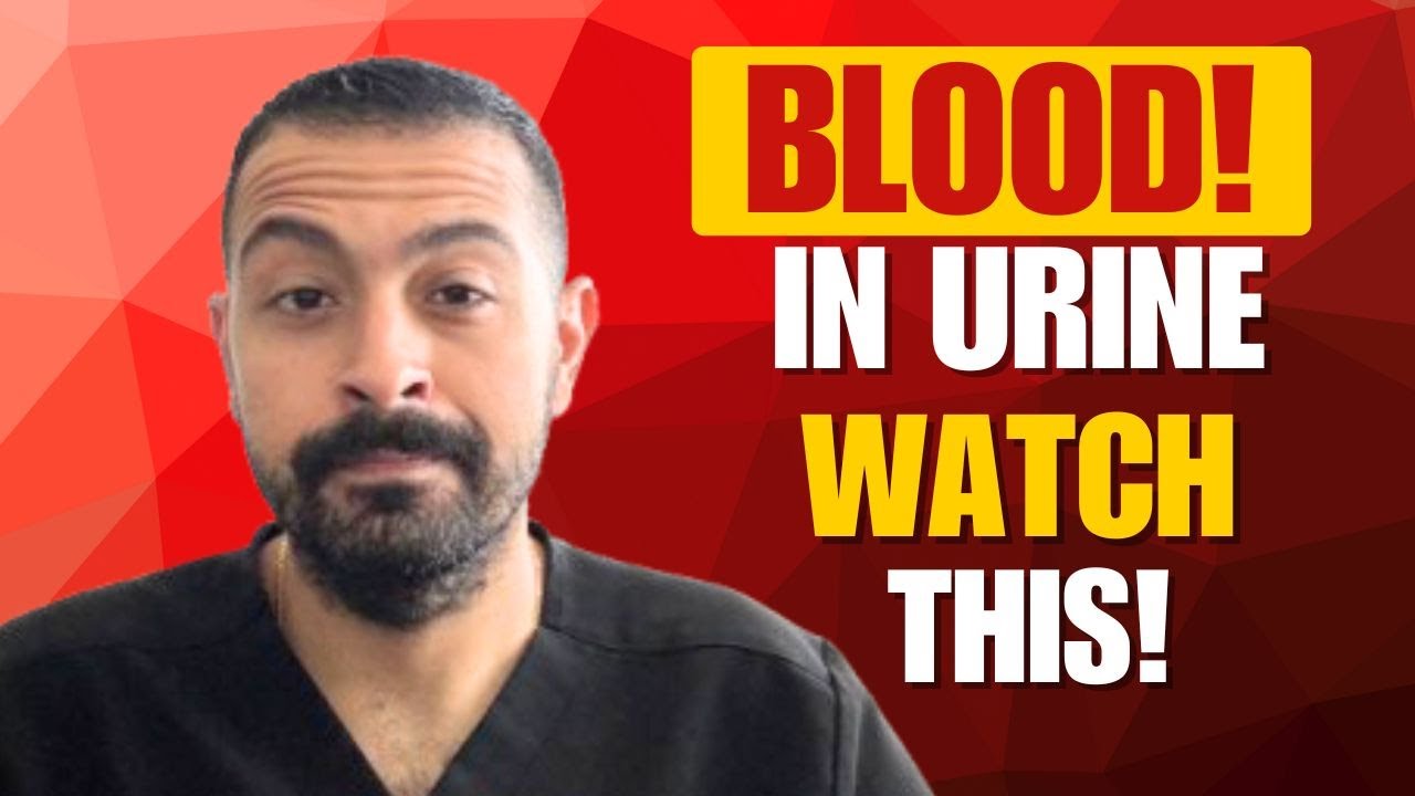 Hematuria: Causes Of BLOOD In the Urine And Management!
