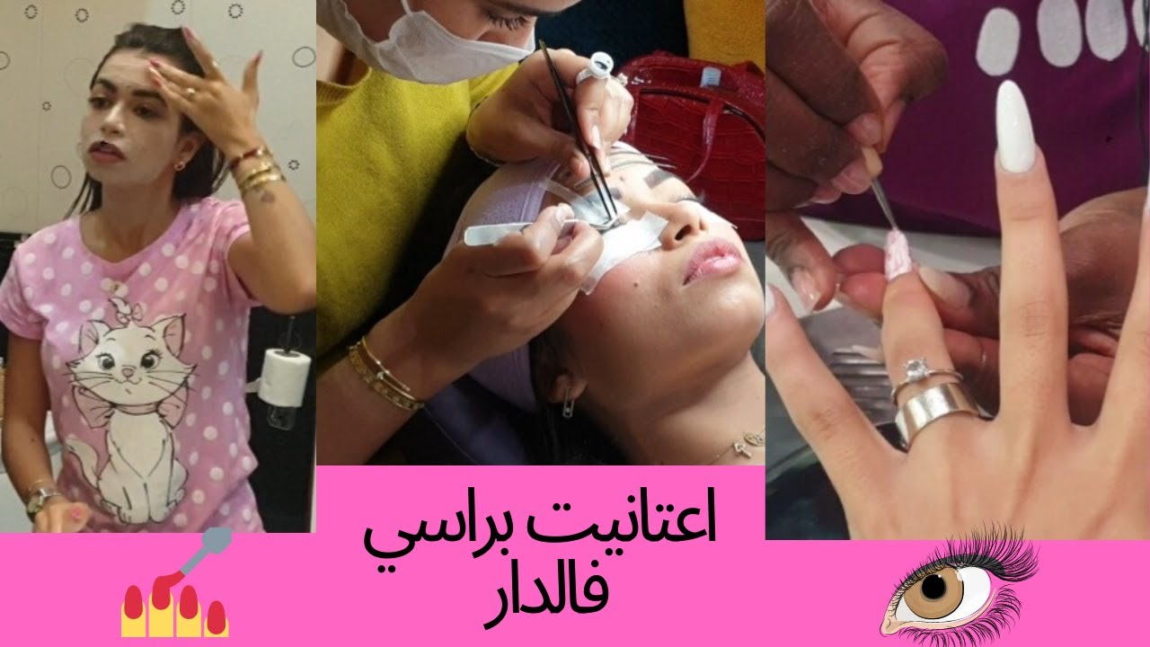 اعتانيت براسي فالدار، ركبت الرموش جاو رائعين