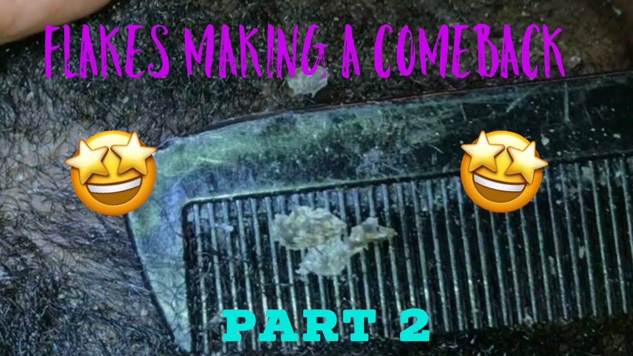 Flakes Making A Comeback Part 2 | Scratchers Anonymous ASMR | Flakes Making A Comeback Part 2