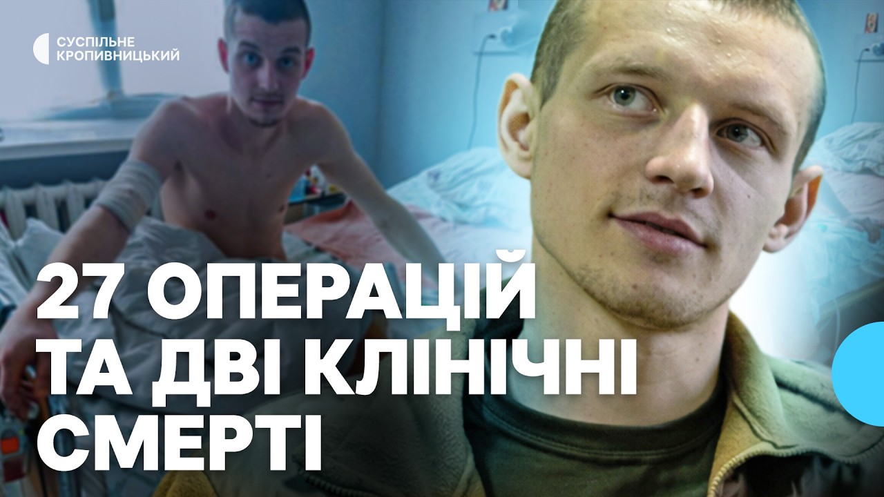 Боєць з Кіровоградщини після поранення переніс 27 операцій, дві клінічні смерті та втратив ногу