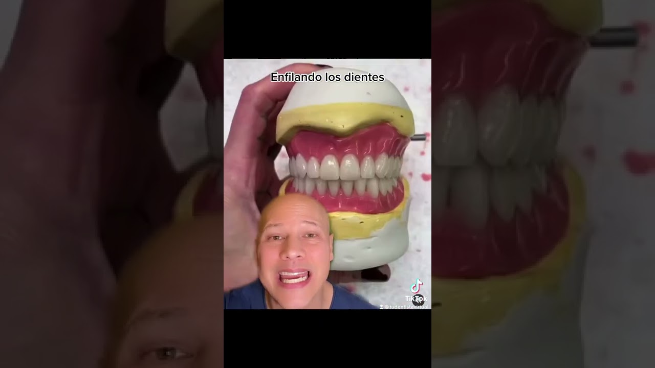 AS&Iacute; SE HACEN LAS PR&Oacute;TESIS PARA REPONER TODOS LOS DIENTES.