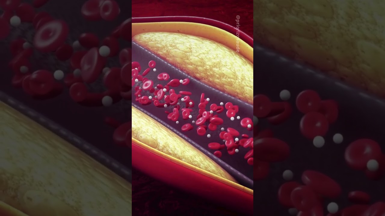 Banha do PORCO é um alimento SAUDÁVEL?