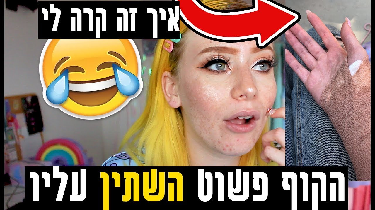 שעת סיפור | איך נהיו לי חורים בכל הגוף(אני בוכה מצחוק)