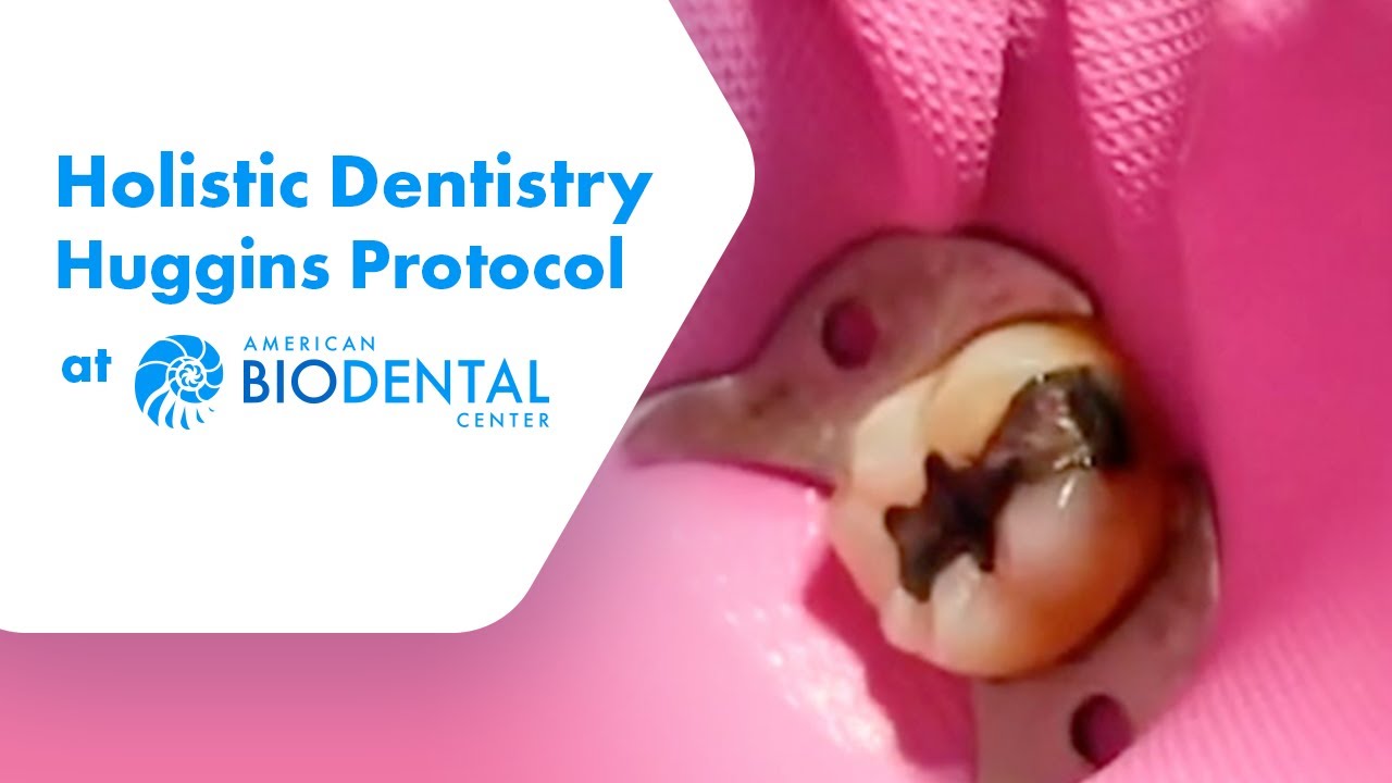 Amalgam Removal with the Huggins Protocol: At American BioDental Center