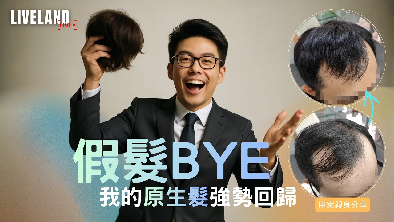 假髮BYE｜禾地活髮｜Live Land｜生髮｜脫髮｜防脫髮