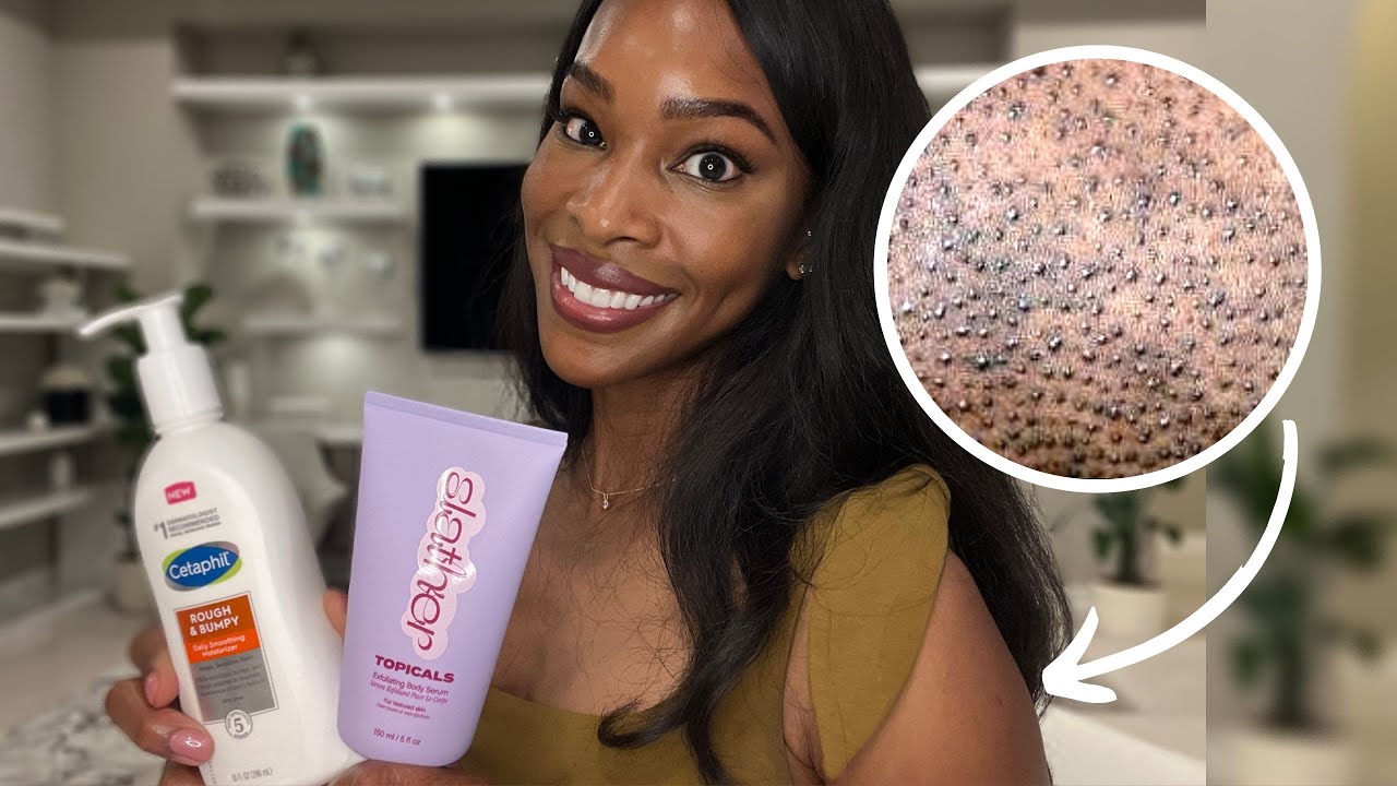How to Get Rid of Textured, Bumpy, Rough Skin | Keratosis Pilaris