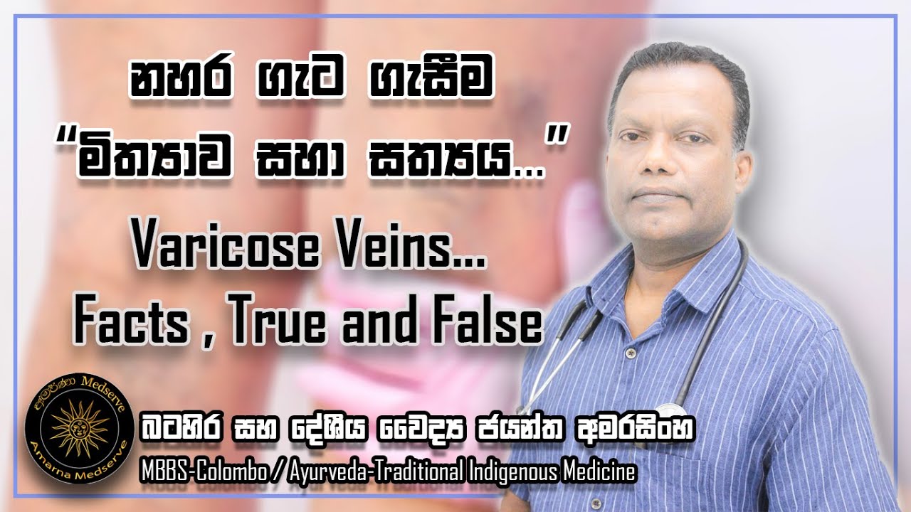නහර ගැට ගැසීම - 