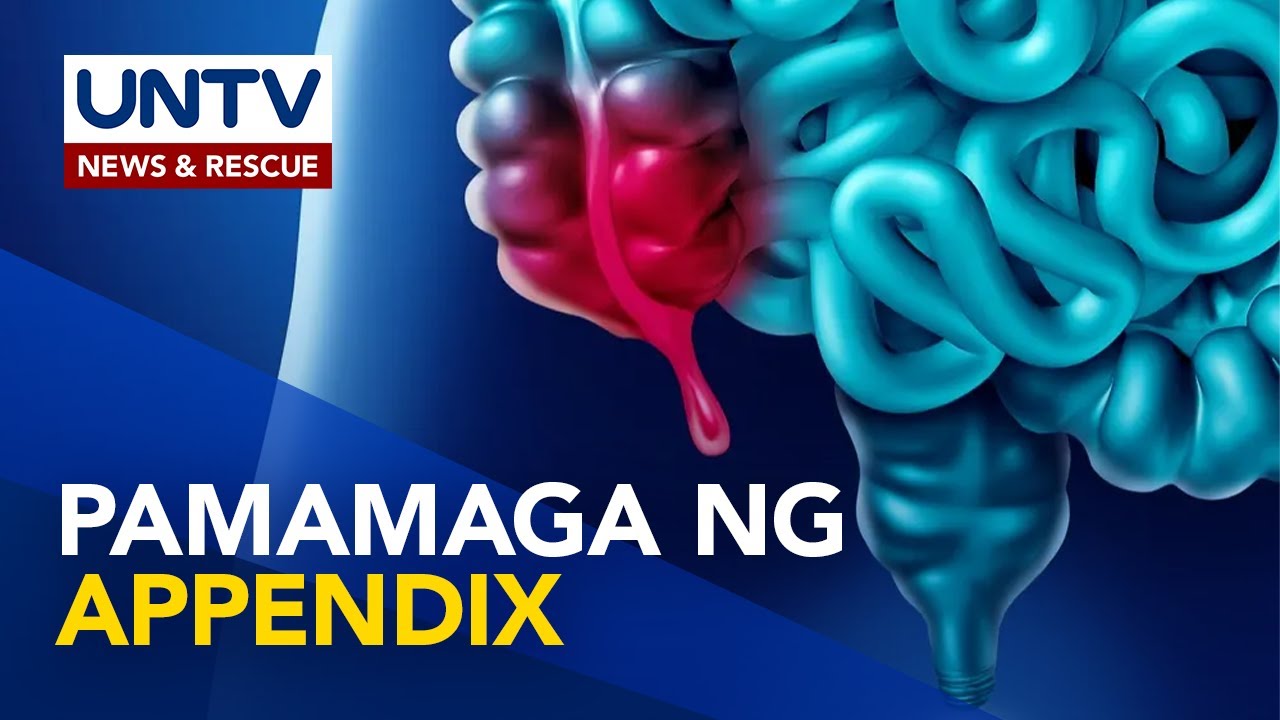 Appendicitis: bakit nagkakaroon nito, ano ang sintomas at paano ito ginagamot? | Now You Know