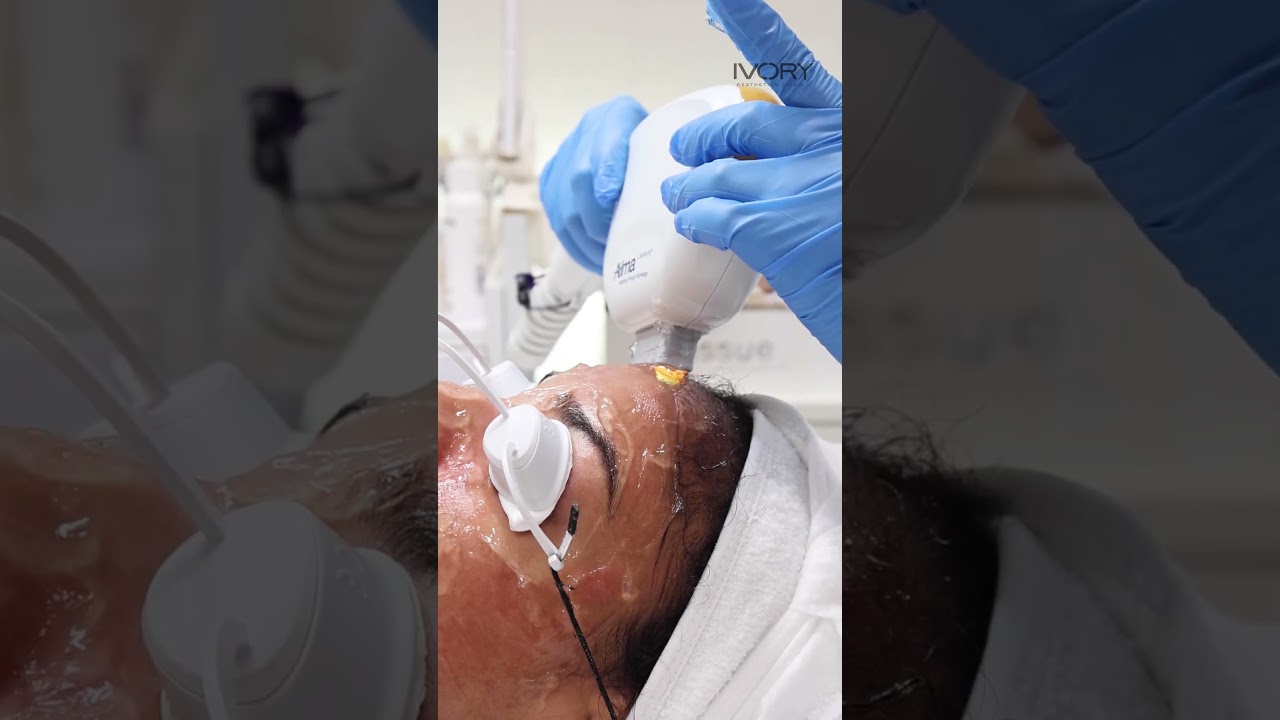 AFT Laser Skin Rejuvenation - Ivory Aesthetics Dubai