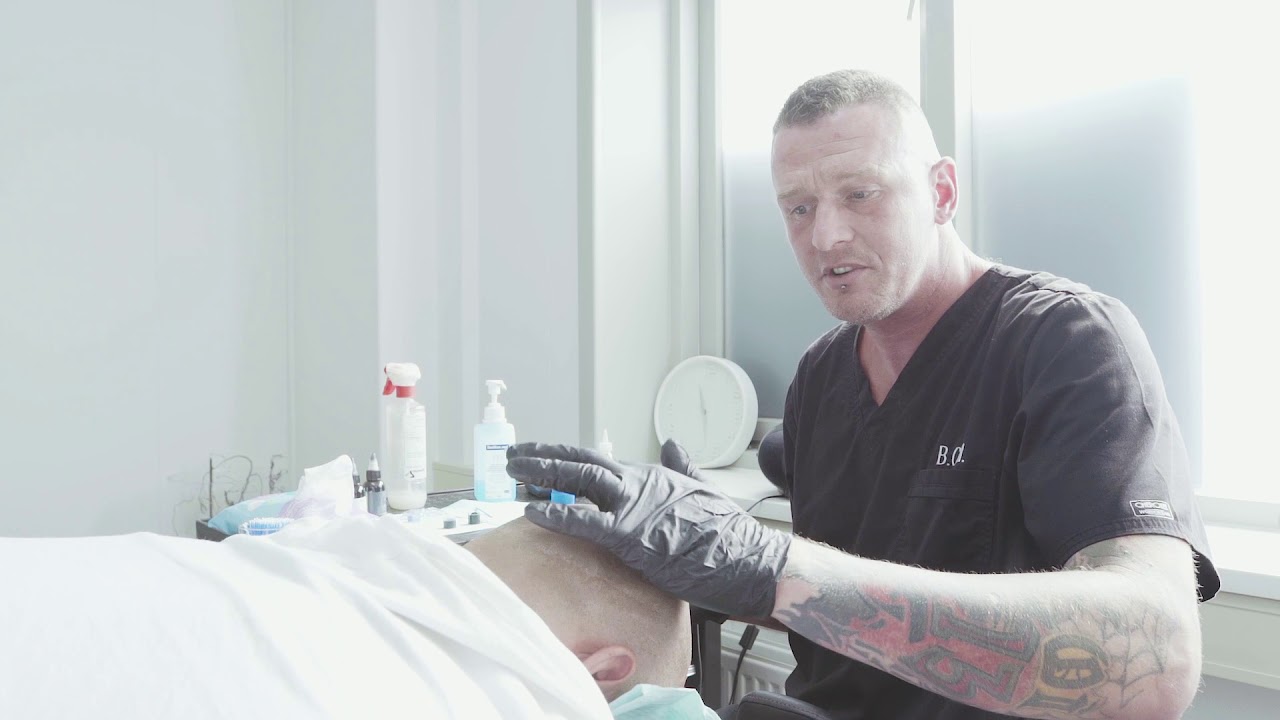Waarom zijn er 2 behandelingen nodig? - Micro Hair Pigmentation (MHP) Beauterlandy Care Ned